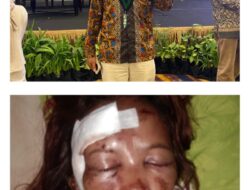 Ketum HMI MPO Kecam Tindakan, Dugaan Penelantaran Pasien “Copot Kepala RSUD Konawe”